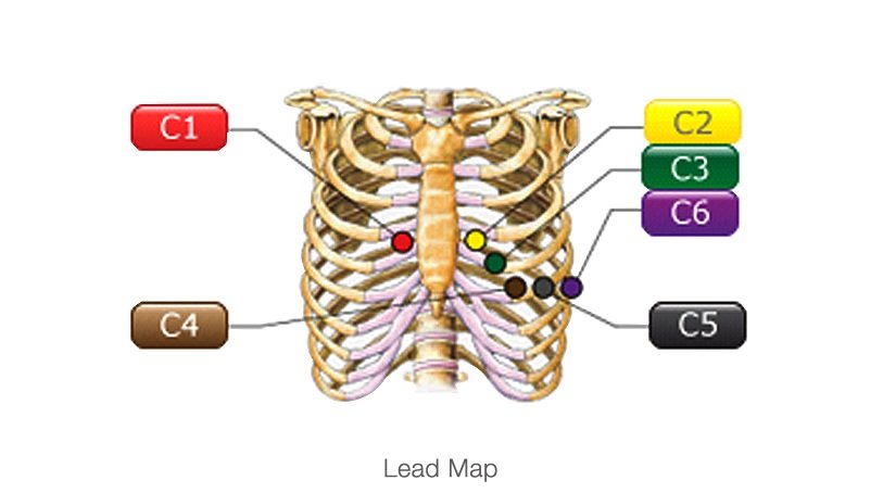 EDAN SE-301 ЭКГ - Электрокардиограф